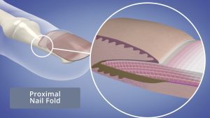 Close up of the Proximal Nail Fold