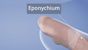 Eponychium