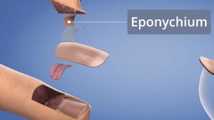 Eponychium