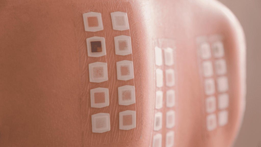 Patch Testing