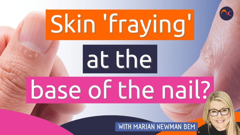 skin fraying nail