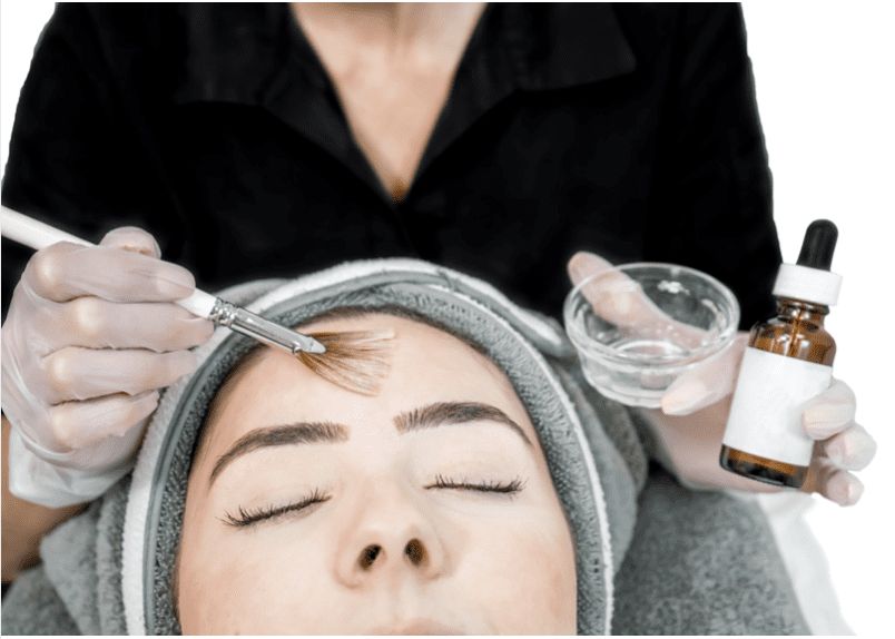 chemical peel