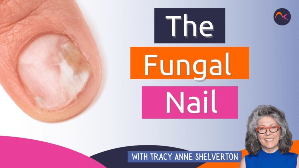 The fungal nail