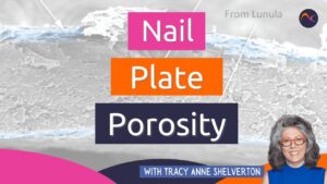 nail plate porosity blog post