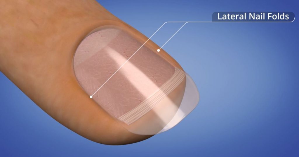 Nail sidewalls