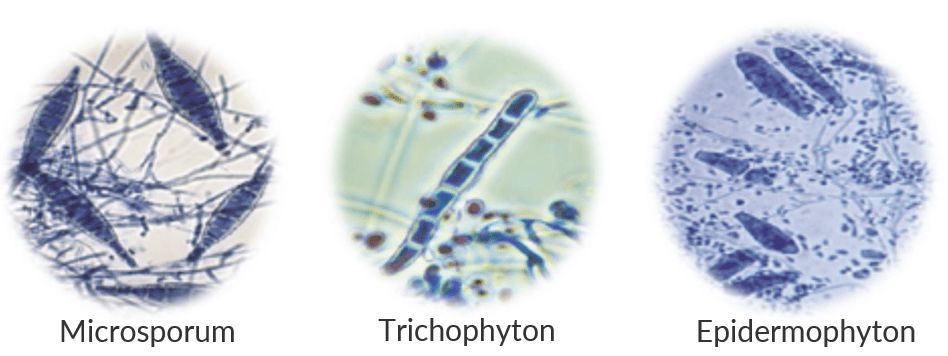 dermatophyten