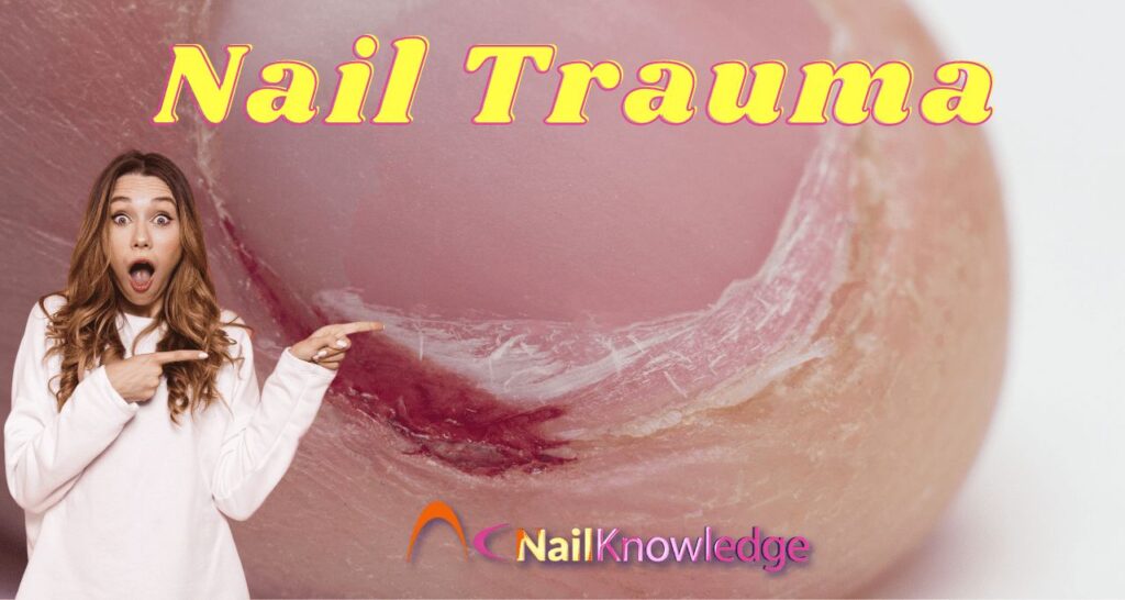Nail Trauma