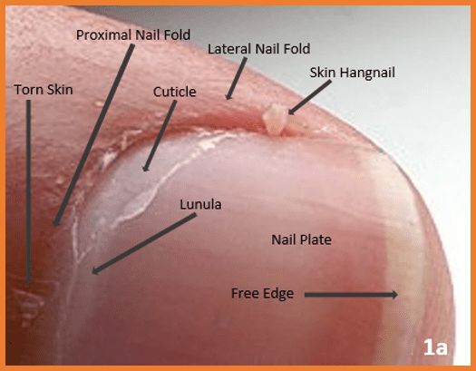 Skin Hangnail