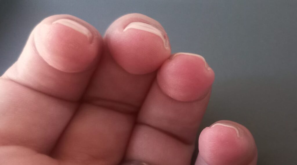 staple nails