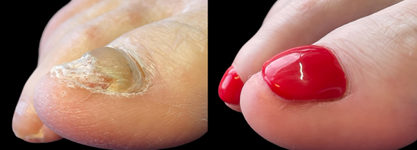 nail plate cosmetic enhancements