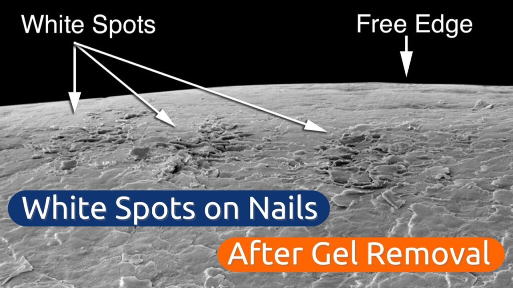 White Spots on Nails Damage or Dehydration