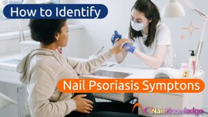 How to Identify Nail Psoriasis Symptoms in Clients