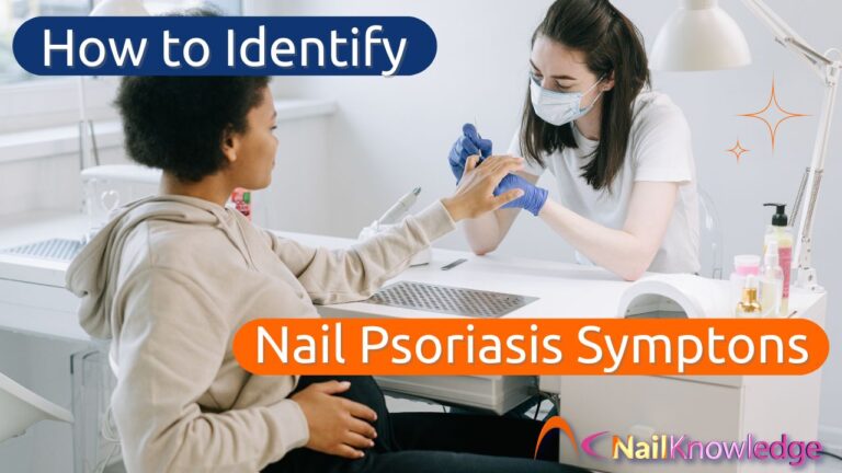 How to Identify Nail Psoriasis Symptoms in Clients