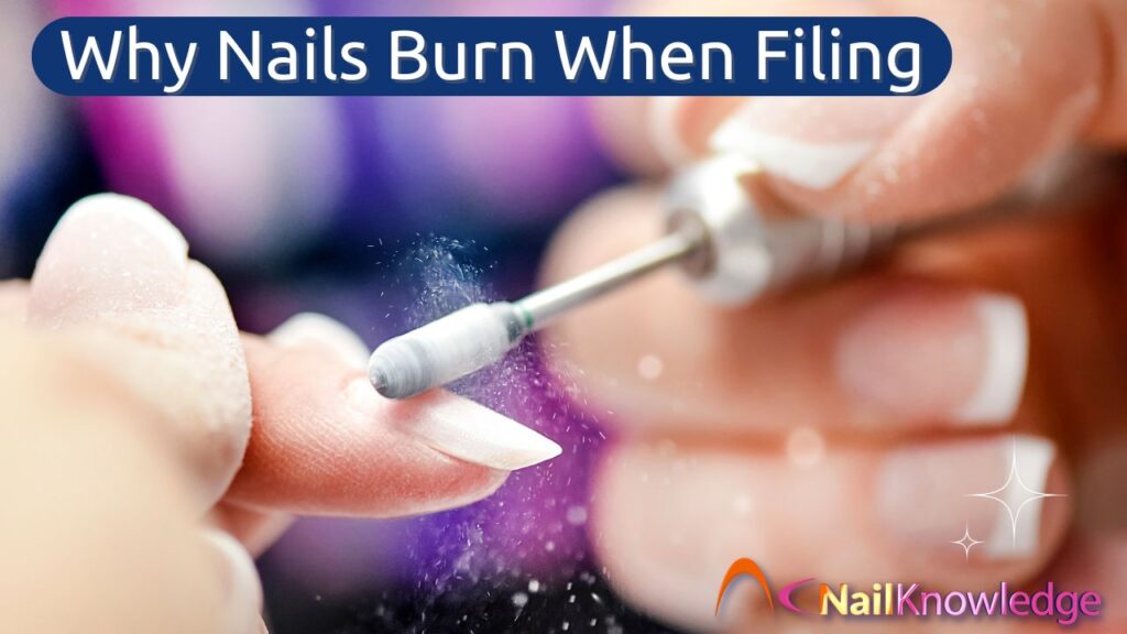 Why Nails Burn When Filing