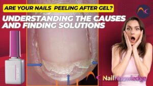 Nail peeling after gel
